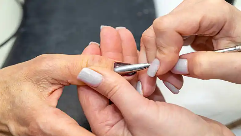 کاشت ژلیکس با رابر بیس