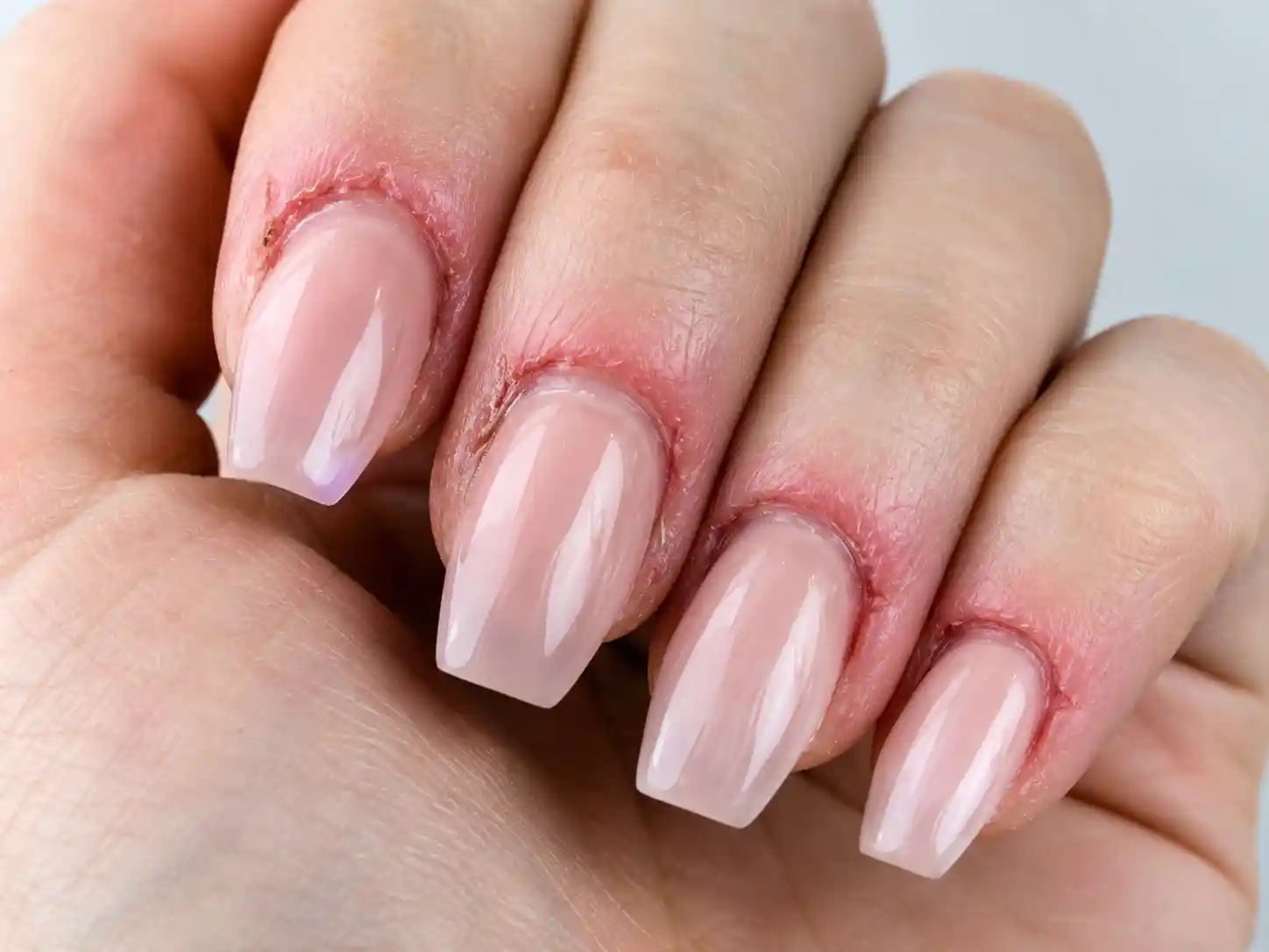 عوارض کاشت ناخن با ژل