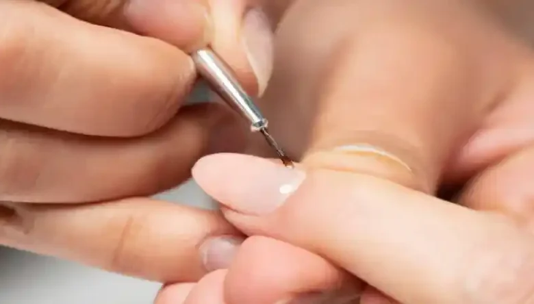 ترمیم ناخن بعد کاشت