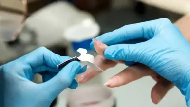 بهترین روش کاشت ناخن
