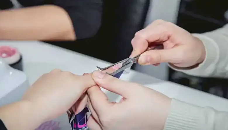 کاشت قالب با بیلدر ژل