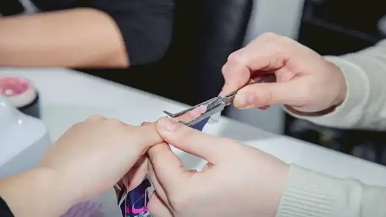 کاشت قالب با بیلدر ژل