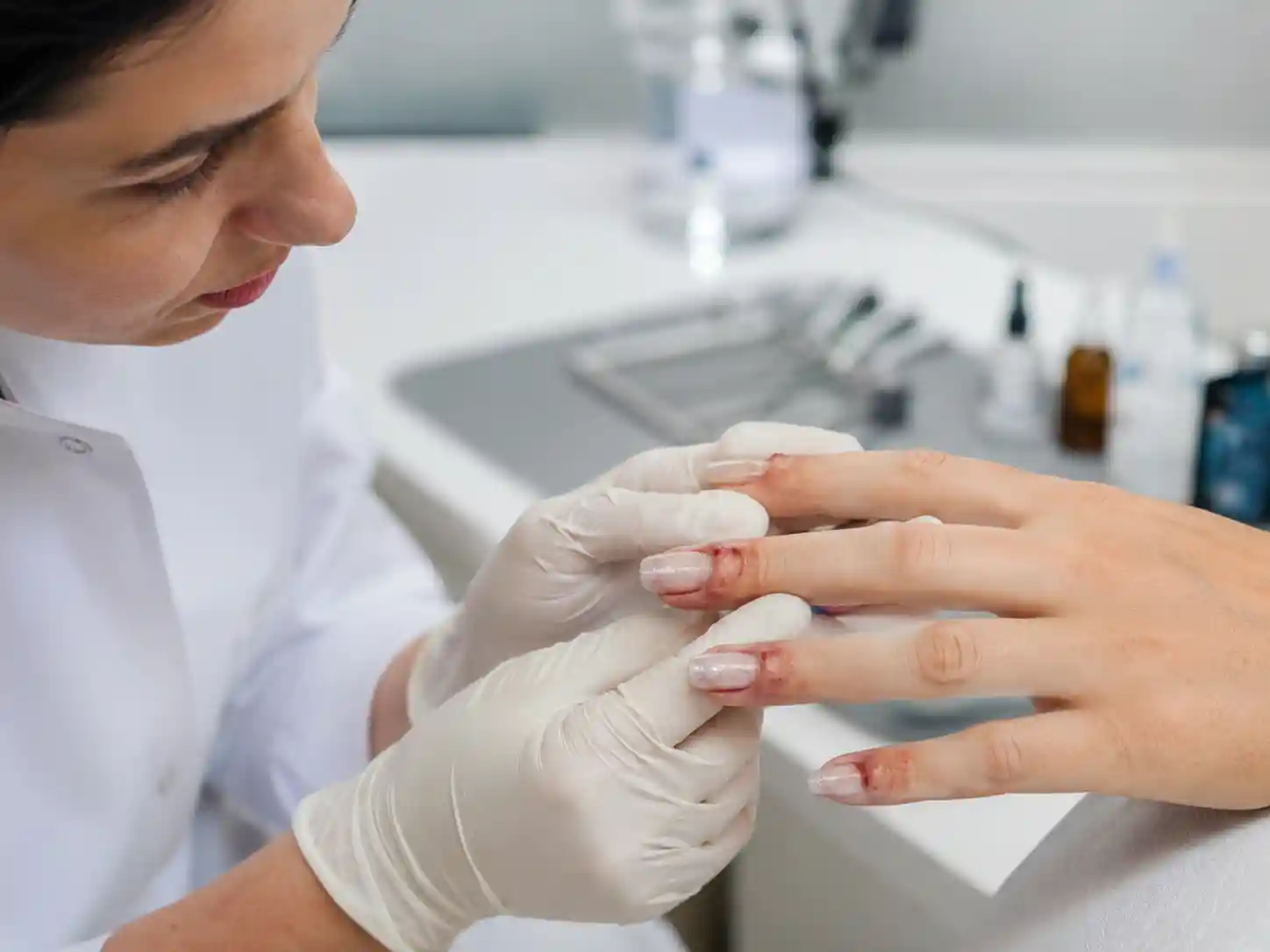 مضرات کاشت ناخن از نظر پزشکی