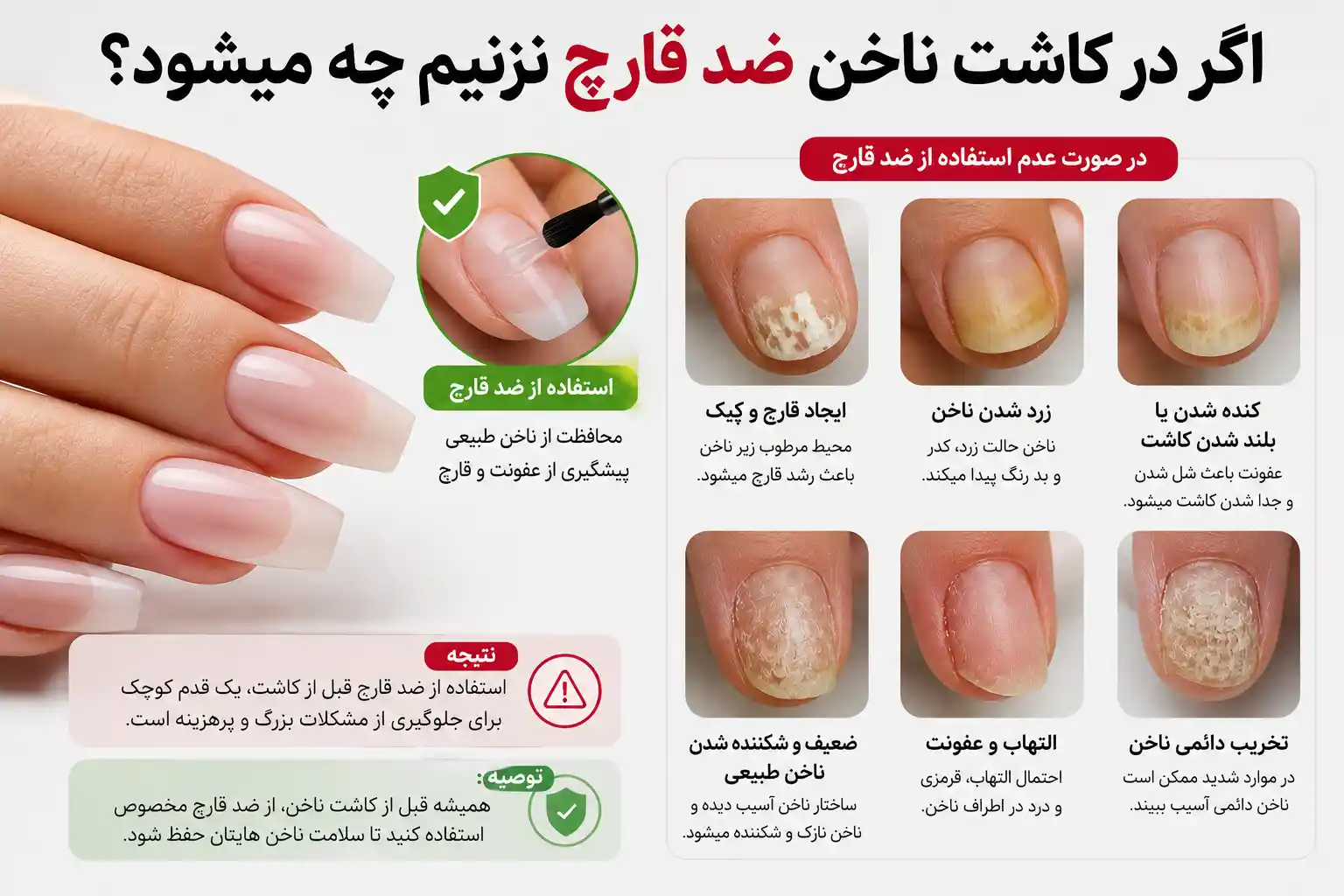 اگر در کاشت ناخن ضد قارچ نزنیم چه میشود